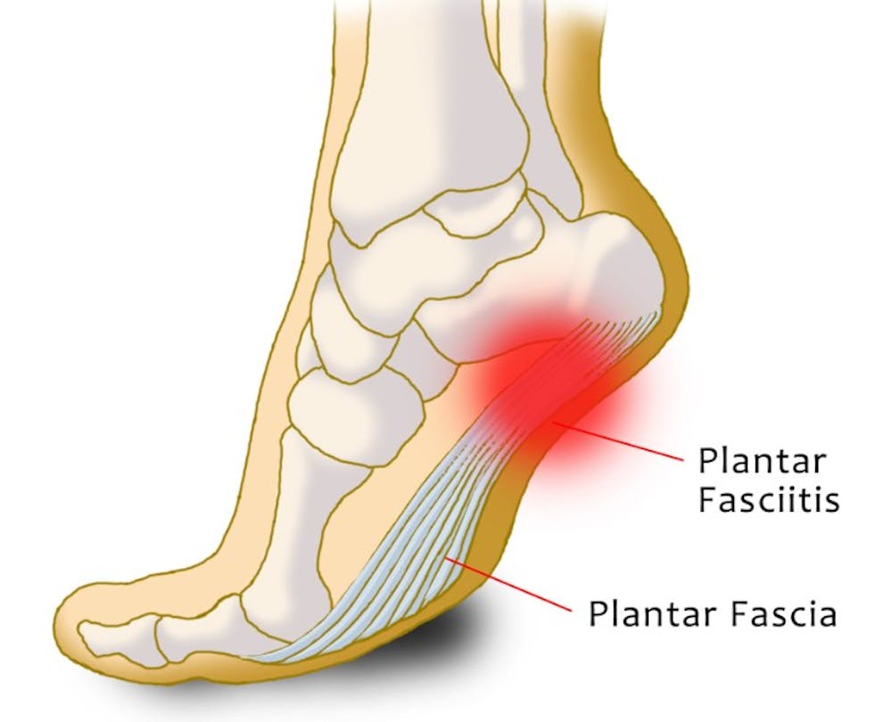 Οι κυριότεροι τραυματισμοί στον μαραθώνιο - Τι πρέπει να προσέξετε runbeat.gr